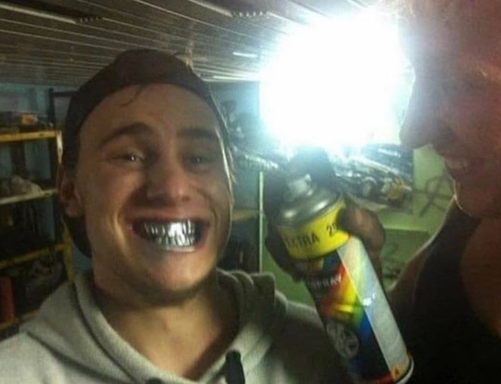 A guy with chrome mouth spray painted by a friend